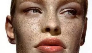 脸上长斑是什么原因(脸上长斑是什么原因怎么消除)-华海博客