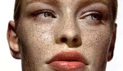脸上长斑是什么原因