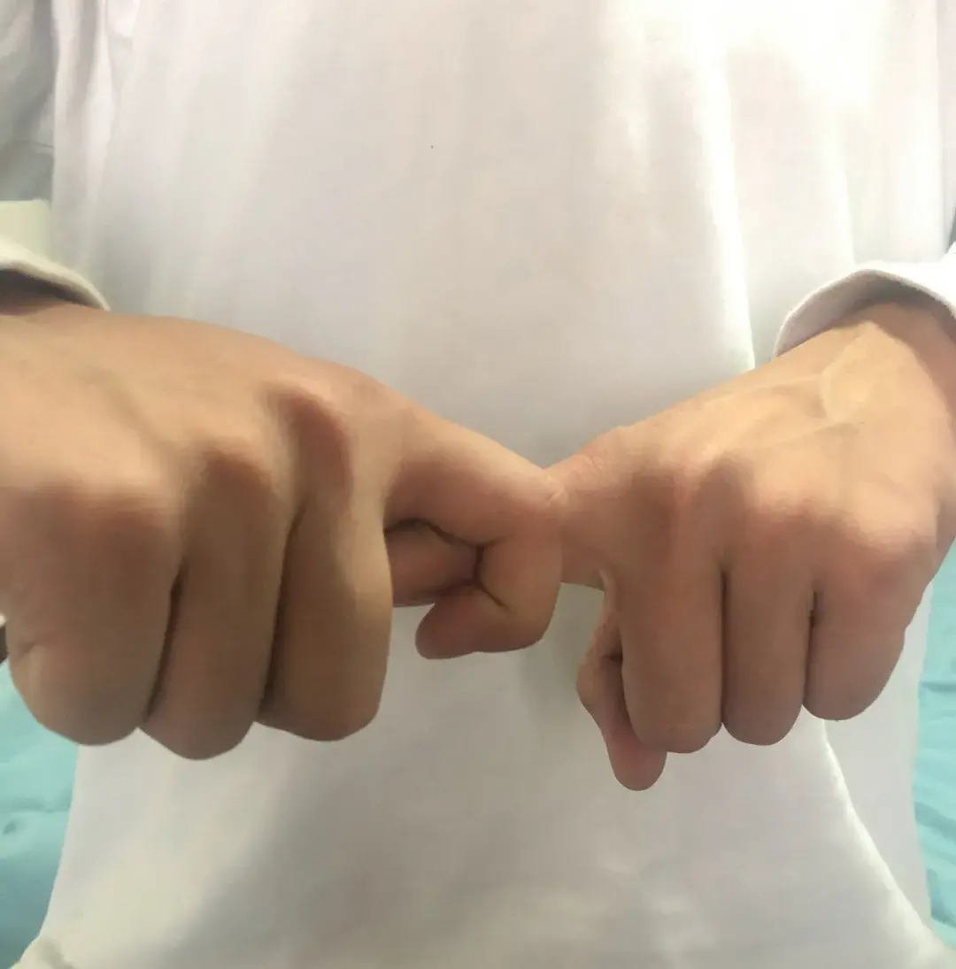 打篮球吃萝卜了怎么快速好（打球时动不动就吃萝卜，怎么应急处理会好得快？）